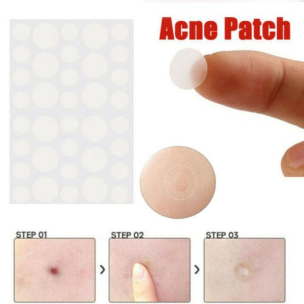 36pcs Hydrocolloid Acne Patch Set Invisible Pimple Skin Tag Remover Patch Blackhead Blemish Remover Cover Acne Face Care Sticker